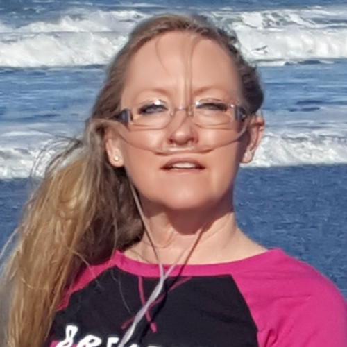 Dina, a woman wearing an oxygen hose and glasses standing in front of the ocean