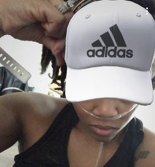 Woman looking fierce wearing an adidas hat plus an oxygen hose